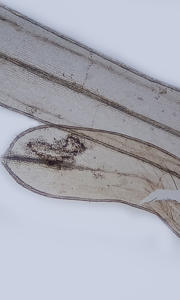 Plant macrofossil studies from Iezerul Latoriței Lake